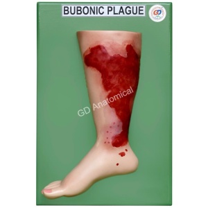 Bubonic Plague Model