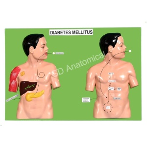 Diabetes Mellitus