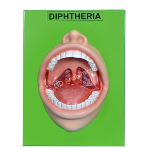 Diphtheria Model