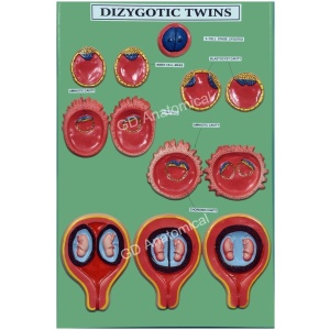 Dizygotic Twins Model