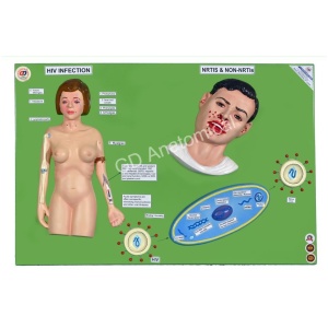 HIV Infection - NRTIS and NON-NRTIS