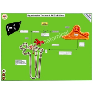 Hypertension Treatment ACE Inhibitors