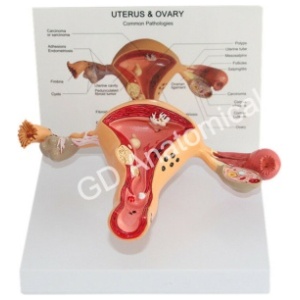 Pathology Models