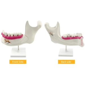 Lower Jaw of an 18-Year-Old