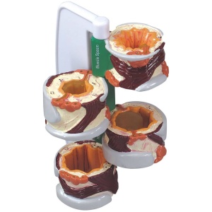 4 Piece Bronchus Anatomy Model