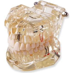 Transparent Dental Model