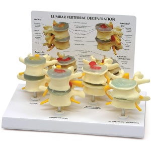 Four Stage Vertebrae Set Anatomy Model