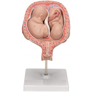 Twin Fetuses Model, 5th Month in Normal Position
