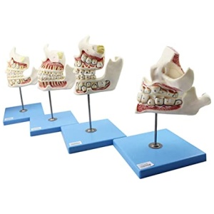 Development of a Set of Teeth Model