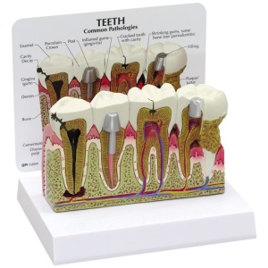Teeth Model